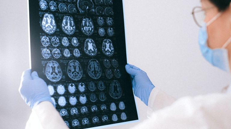 World first trial for paediatric brain cancer launched in NSW