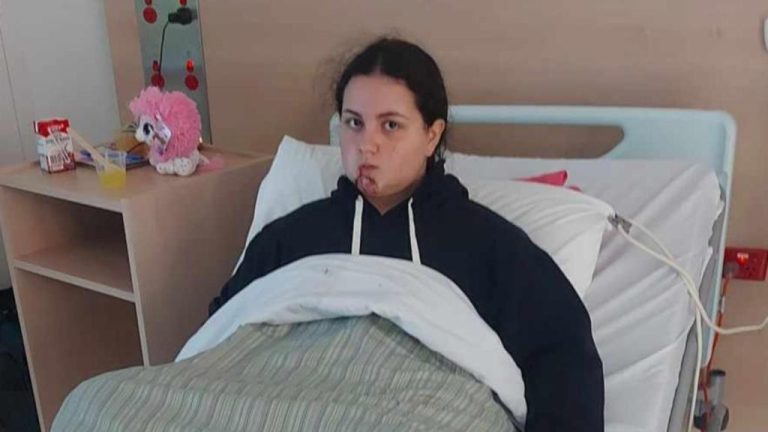 Niki Chrysanthopoulos attacked by family dog in Melbourne