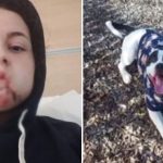 Melbourne girl attacked by family dog