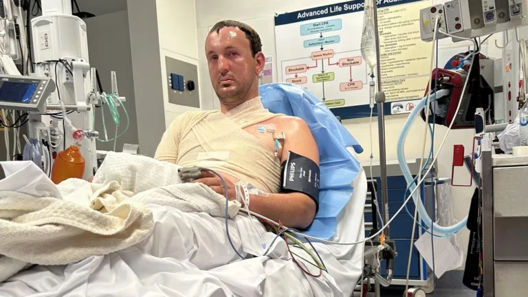 SA man speaks out after bonfire proposal to Elizabeth Parsalidis ends in disaster