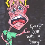 Every-scar-tells-a-story-1