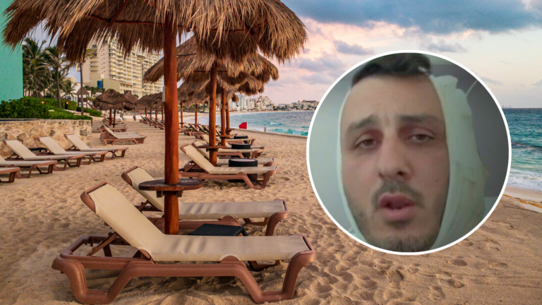 Israeli tourist’s ear bitten in violent beach clash near Athens