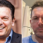 Nick Xenophon opens up on life-changing facial reconstruction surgery